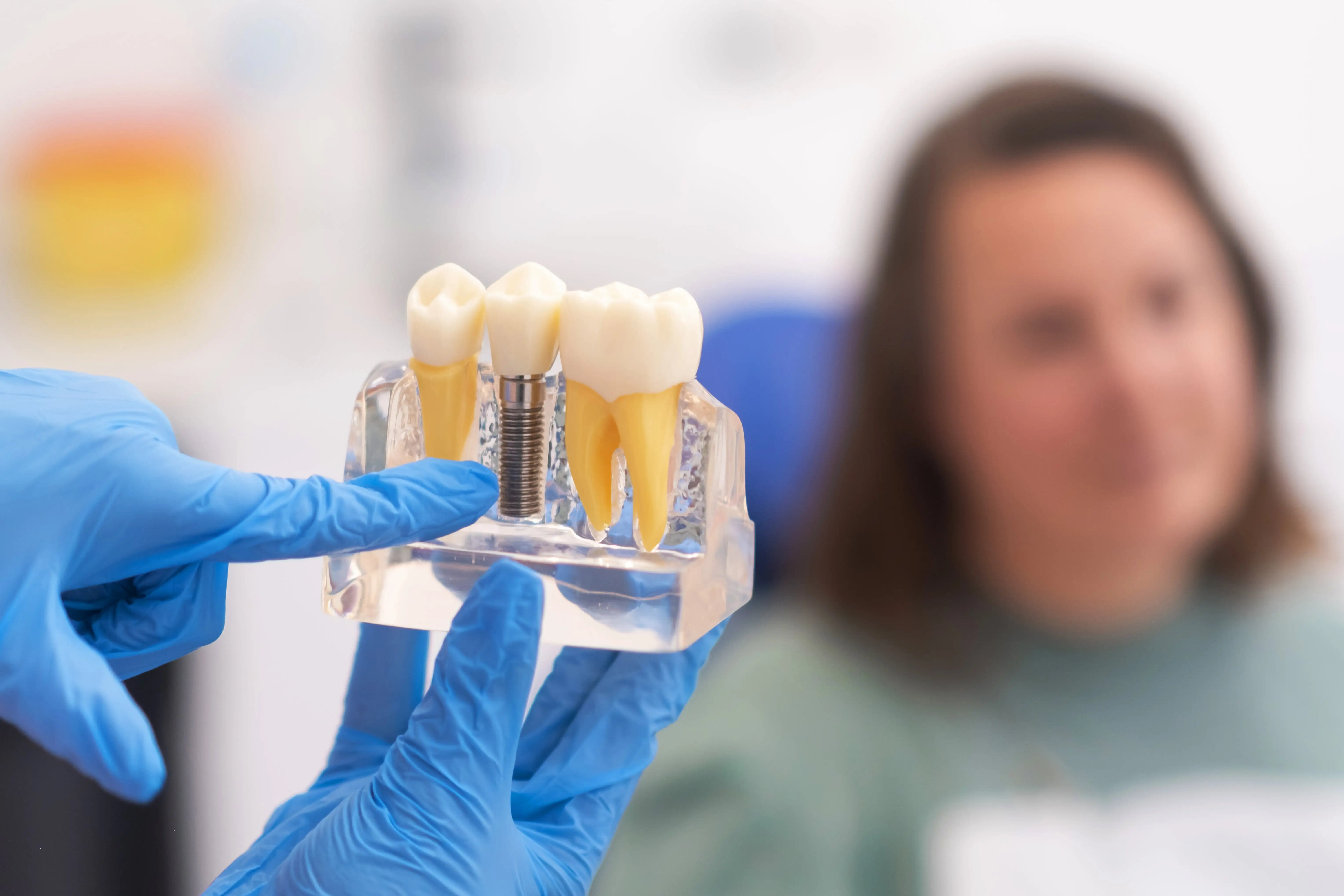 Can an Implant Be Placed Immediately After Tooth Extraction?