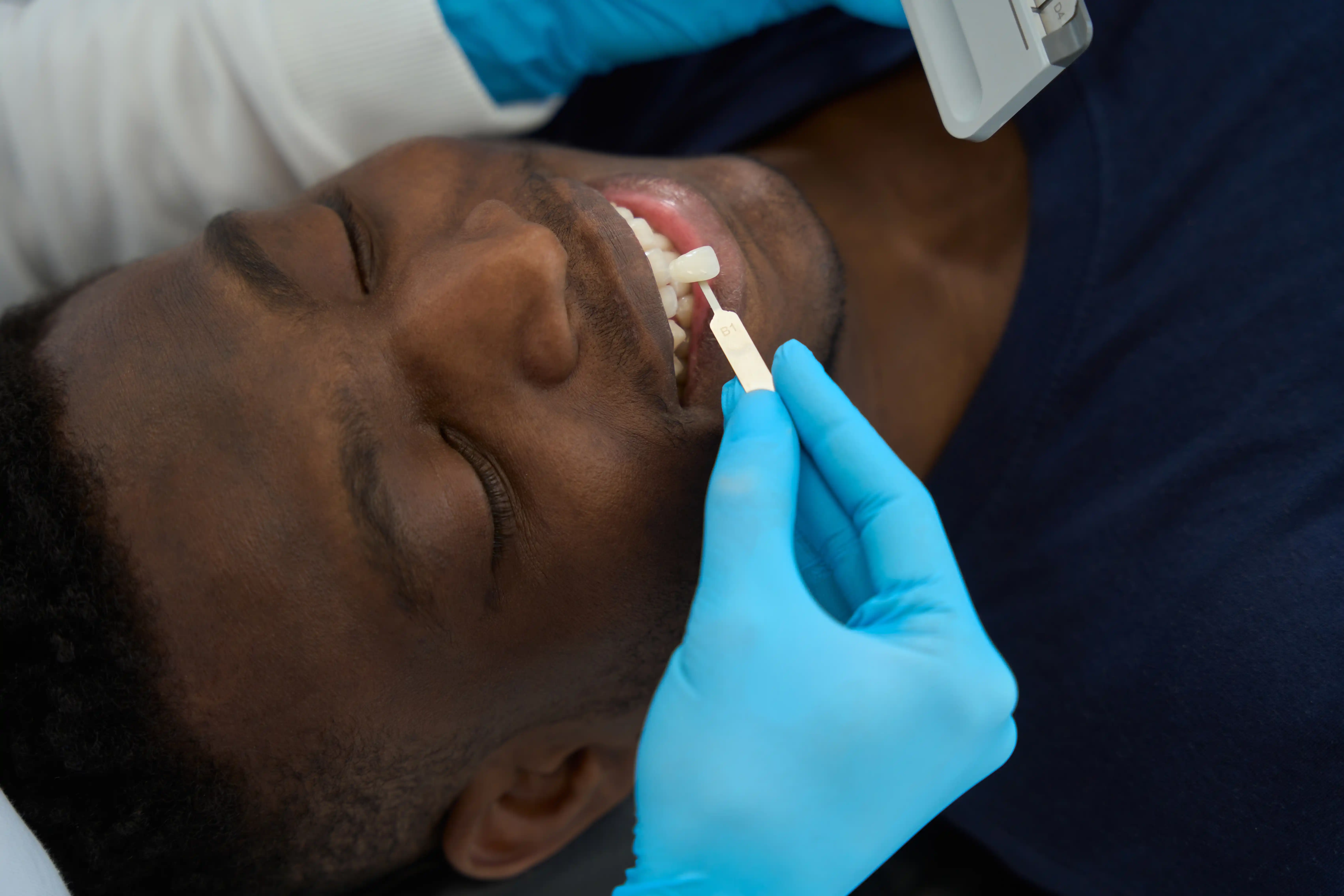 A smiling patient showcasing their Emax veneers after treatment at Moon Smile Clinic.