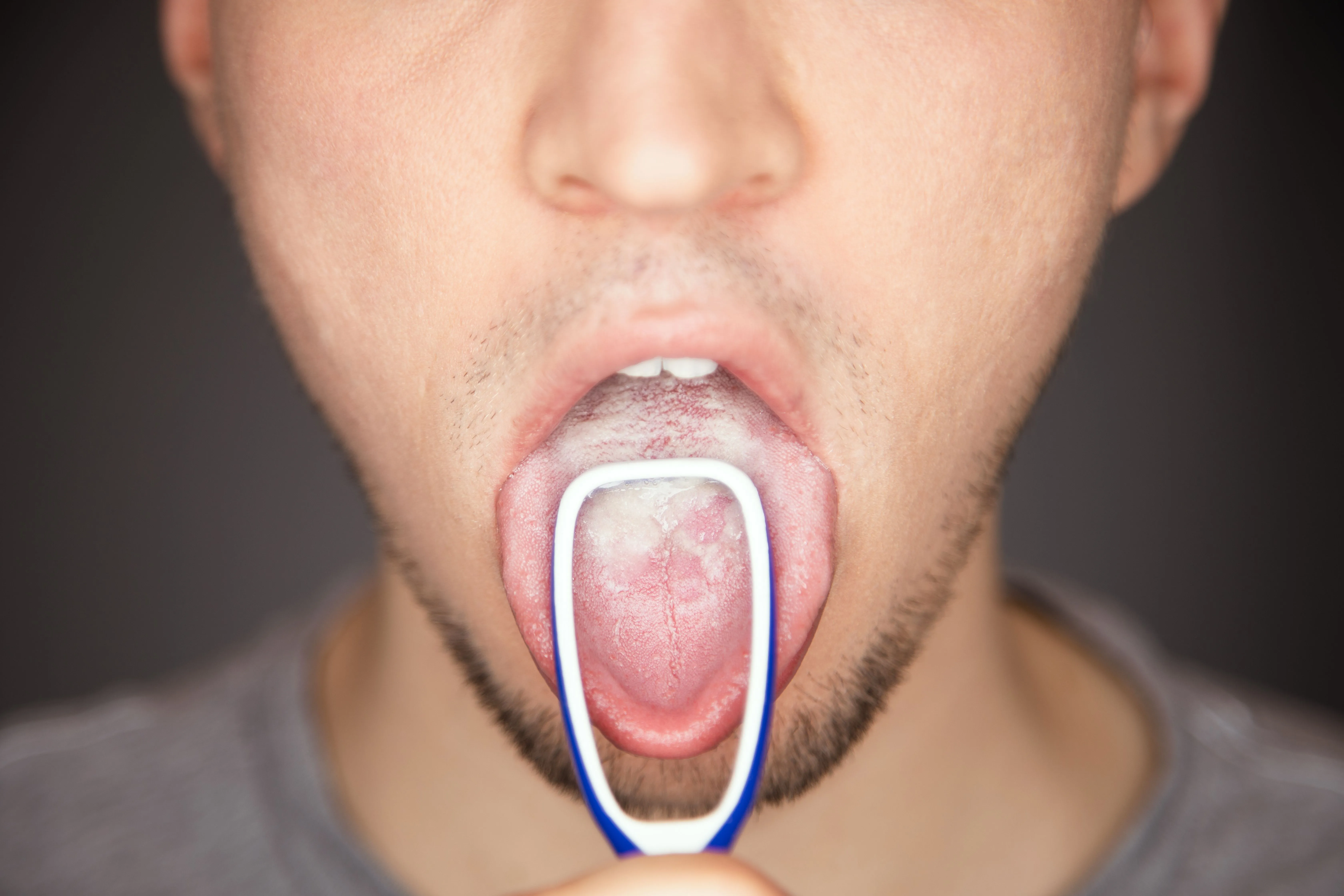 Why Should We Clean Our Tongue?
