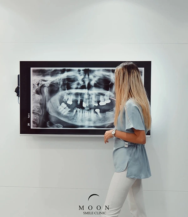 Aesthetic Dentistry