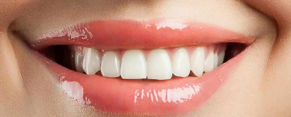 cosmetic-bonding