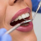 smile design